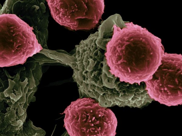 AACR Annual Meeting 2018: Novel Immunotherapy Combinations to Combat Resistance to Checkpoint Inhibition